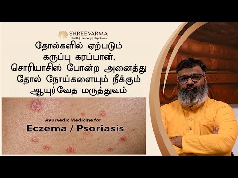 சொரியாசிஸ் போன்ற அனைத்து தோல் நோய்களையும் நீக்கும் ஆயுர்வேத மருத்துவம்