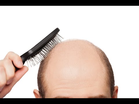 Video: DHT: Kaip Tai Lemia Plaukų Slinkimą Ir Kaip Juos Sulėtinti
