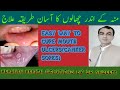 Mouth ulcers(canker sores) causes, treatment and precautions,