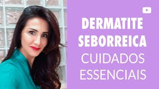 Tópicos seborreica dermatite couro ou agentes para anti-inflamatórios cabeludo face da