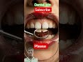#dental #join #teeth #and #shine 🦷💉🏥💊🦷🏥💉