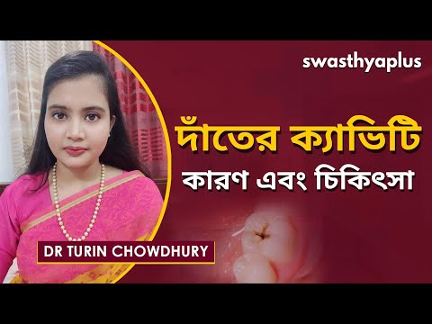 দাঁতের ক্ষয় এবং ক্যাভিটি । Dr Turin Chowdhury on Dental Decay & Cavity in Bangla