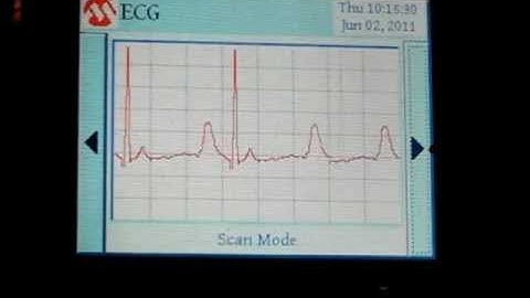 GLCD with TouchScreen