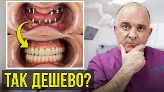 Имплантация при полной потере зубов! Самый бюджетный способ