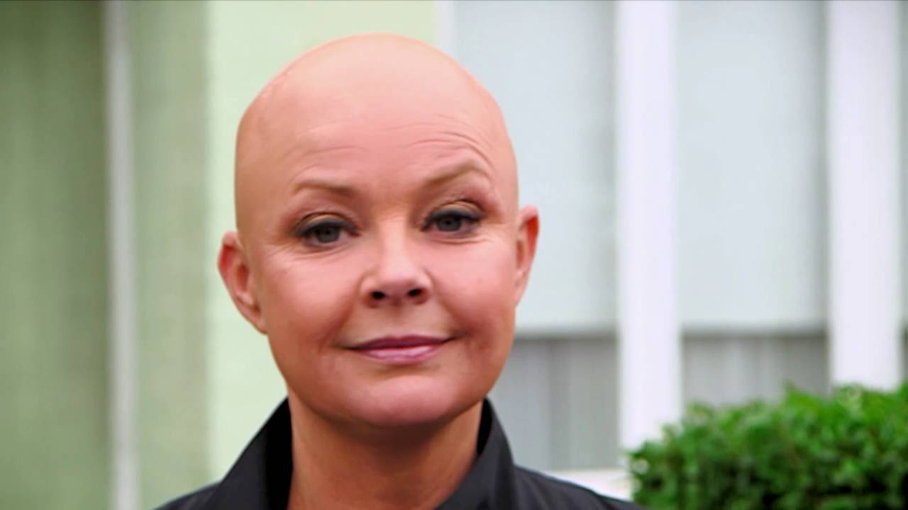 Series 2 trailer | Celebrity Botched Up Bodies | Channel 5