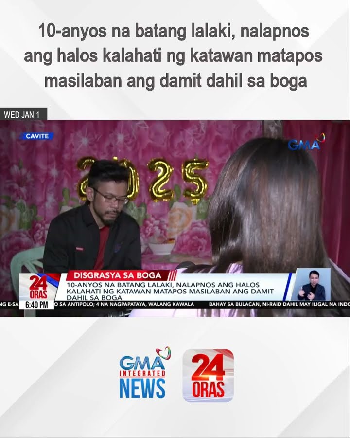 10-anyos na batang lalaki, nalapnos ang halos kalahati ng katawan matapos masilaban... | 24 Oras