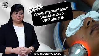 Hydrafacial Treatment: Get rid of Acne, Pigmentation, Blackheads, & Whiteheads | Dr. Nivedita Dadu