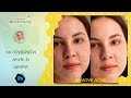 Як прибрати акне у Photoshop (Photoshop tutorial: Skin Retouching in Photoshop)