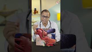 DDH (Hip Problem) in Babies: Early Signs & Prevention!
