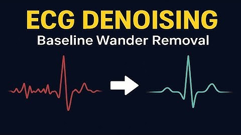 ECG Signal Denoising in Python | Baseline Wander Removal with Wavelets
