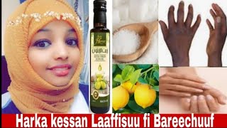 Harka Keessan Kan Gurraacheyefi Kan Saamunaan Gara Garaa Balleesseef Dawaa Kana Fayyadamaa