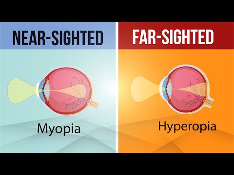 Difference In Myopia And Hyperopia Near Sighted And Far Sighted Class 10 Letstute Cbse Youtube