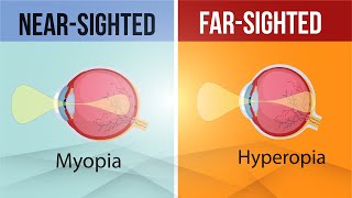 Difference in Myopia and Hyperopia | Near-sighted and Far-Sighted Lens | Class 10 | Letstute CBSE