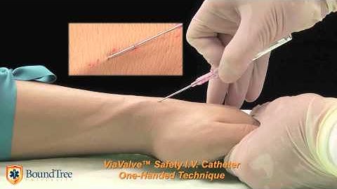 ViaValve™ One-Handed Technique