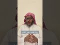 تفسير رؤيا الضرب في المنام عمر المالكي 