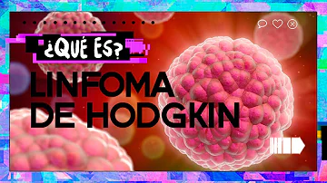 ¿Dónde empieza el linfoma de Hodgkin?