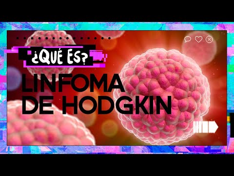 ¿Qué es el linfoma de hodgkin?
