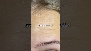 Зморшки? Тобі потрібна ця сироватка від @recare.formulations