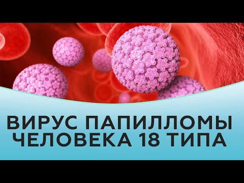 Вирус папилломы человека 18 типа