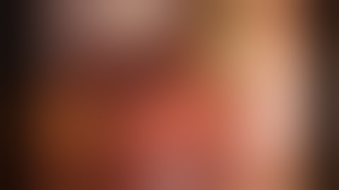 Robotic Cholecystectomy with Intraoperative Cholangiogram and ICG