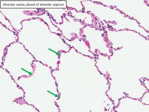 Histology of the lung explained by a pulmonary pathologist, part 1