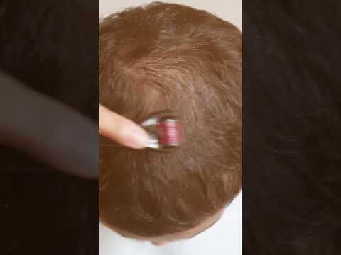 What Is Pitta Dosha Know The Signs Balance It Naturally Shorts