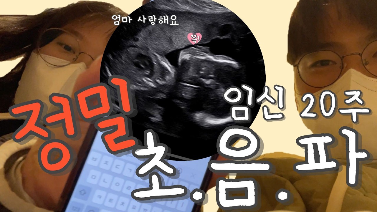 임신 20주차 정밀 초음파 후기!