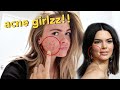 I went to Kendall Jenner's dermatologist to save my skin *acne struggles* | Summer Mckeen