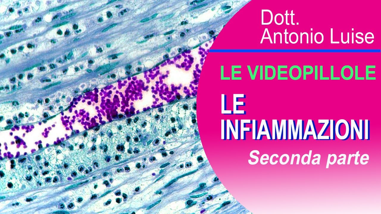 Le Infiammazioni 2