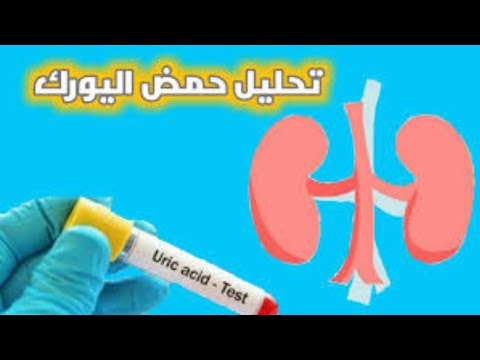 تحليل اليوريك اسيد تحليل حمض اليوريك ارتفاع مستوي حمض اليوريك فرط حمض يوريك الدم يوريك اسيد