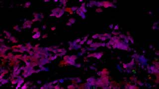 dense optical flow 000