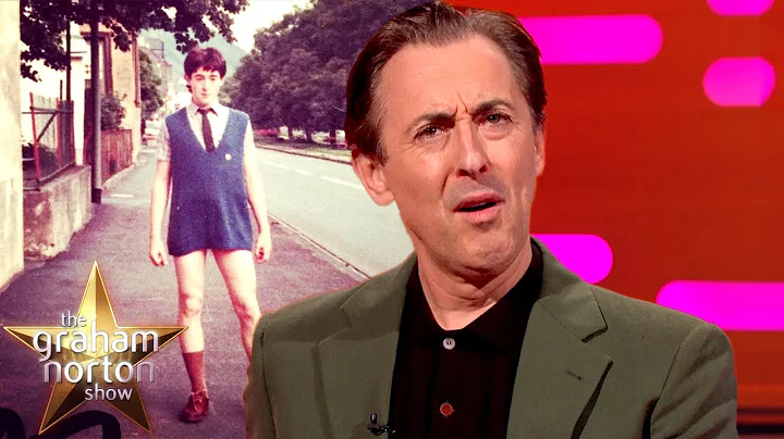 Alan Cumming's Embarrassing School Picture | The G...