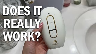 Does The Lumi Hair Removal Device From RoseSkinCo REALLY Work?