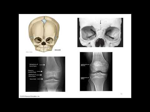 Chapter 9 Articulations