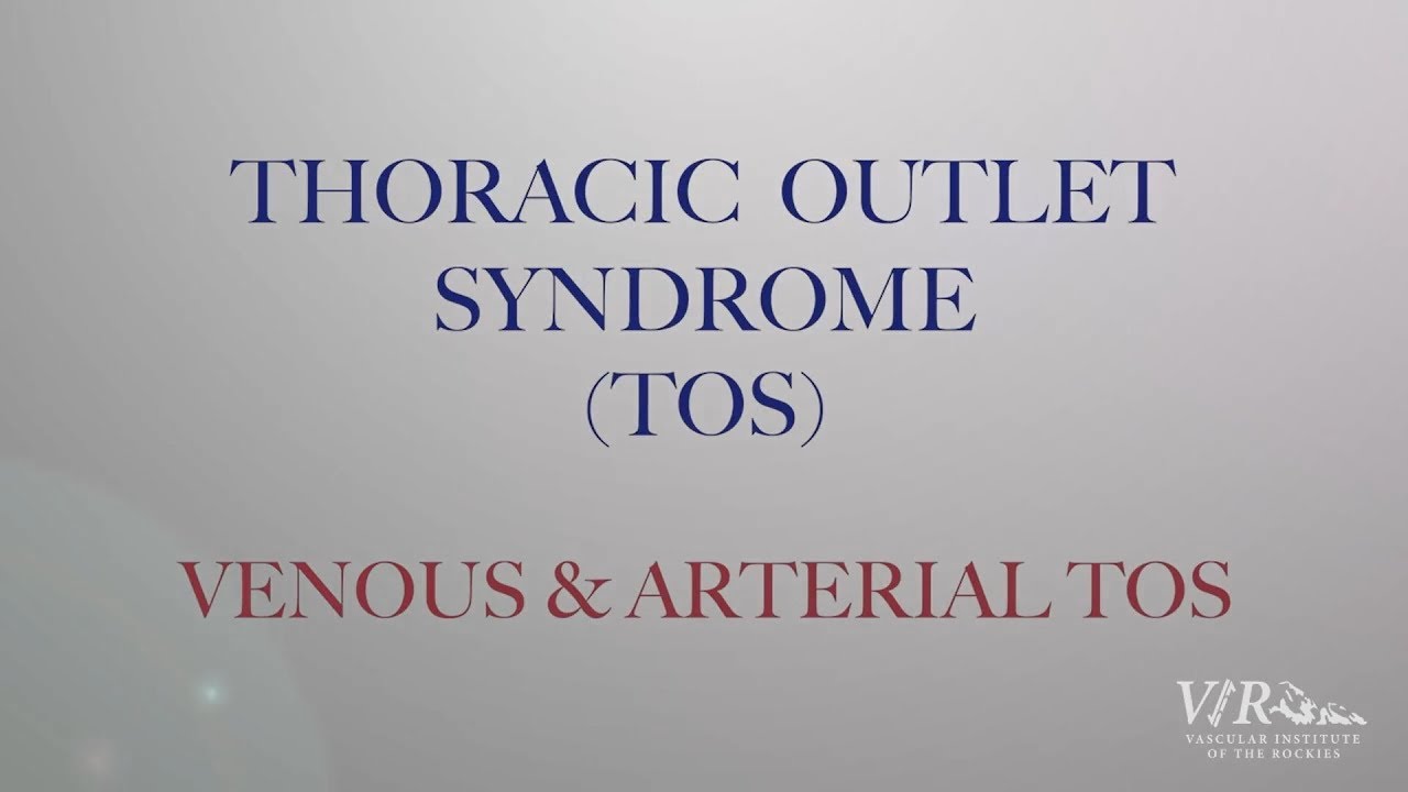 Venous and Arterial Thoracic Outlet Syndrome