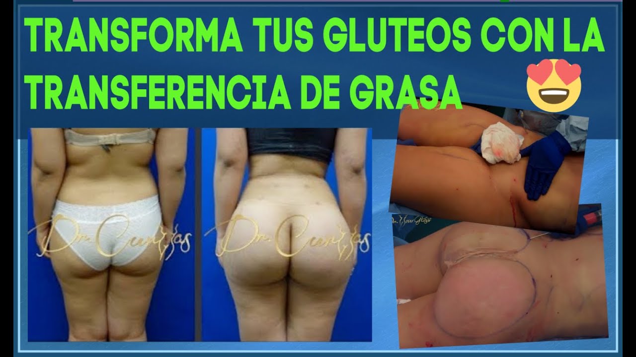 Grasa en las caderas