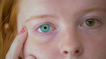 iEye Speculative Design