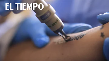 ¿Se puede borrar un tatuaje?