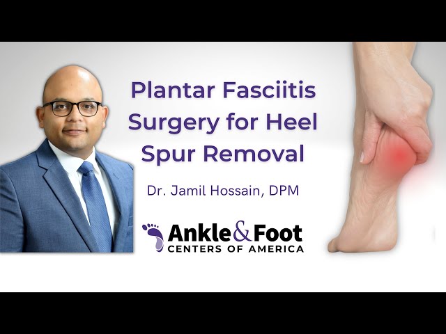 Plantar Fasciitis and Bone Spurs - OrthoInfo - AAOS