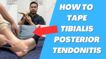 How to tape tibialis posterior tendinitis