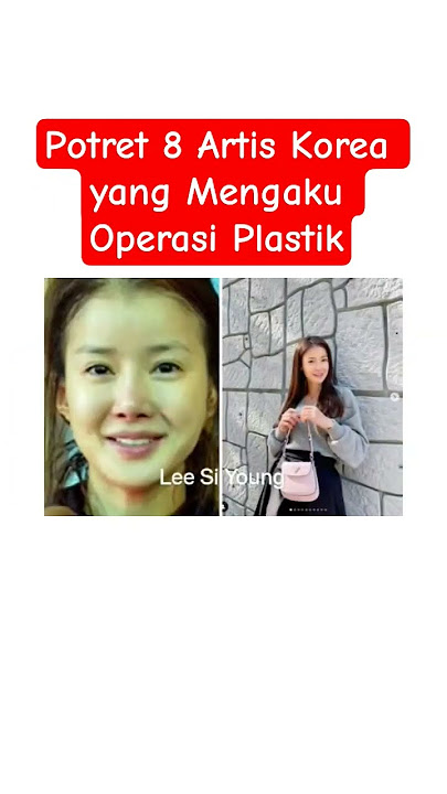 8 Artis Korea Yang Mengaku Melakukan Operasi Plastik#viral #trending #koreanartists