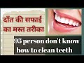 How to clean teeth! Right way [teeth cleaning right way]  दाँत सही तरीके से साफ करना।