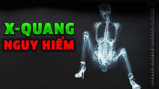 Chuyện NGUY HIỂM gì xảy ra khi bạn chụp X-Quang