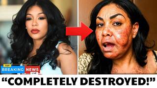 20 Black Actors Who RUINED Their Careers With PLASTIC SURGERY