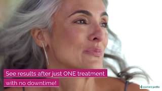 Advanced Rejuvenation Centers Cutera Secret RF