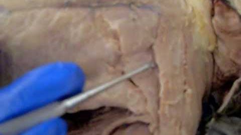 Cat Dissection part 1