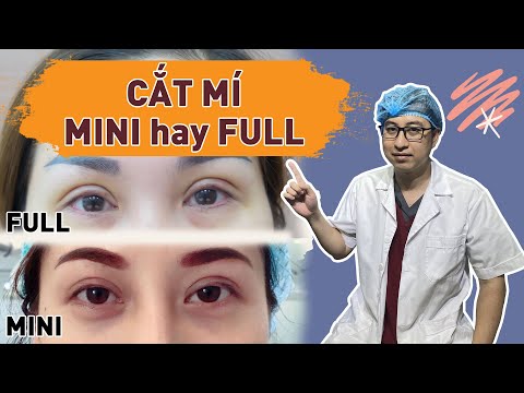 Nên cắt mí Mini hay full toàn bộ? | Bs Mạnh Nên cắt mí Mini hay full toàn bộ? | Bs Mạnh