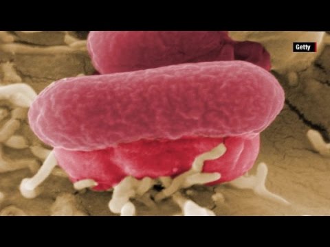 Video: E coli mikroskopikdirmi?