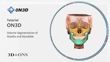 [ENG SUB] Volume Segmentation of Maxilla & Mandible