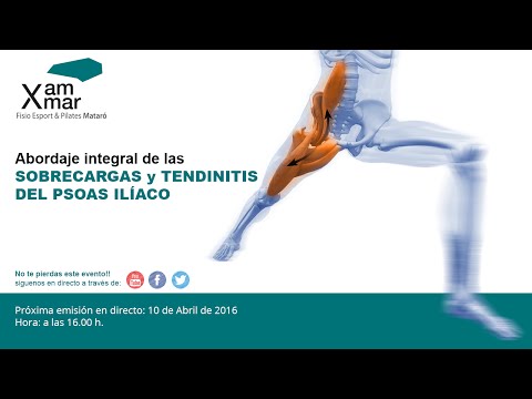 SOBRECARGAS Y TENDINITIS DEL PSOAS ILÍACO